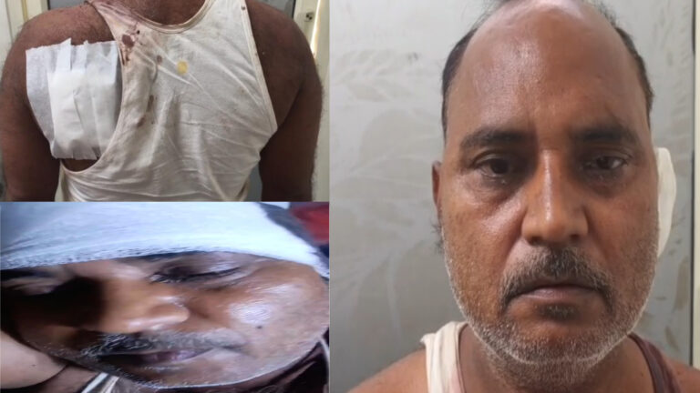 “वर्दी पर दाग” police को सूचना के बाद भी बुजुर्ग पर जानलेवा हमला !